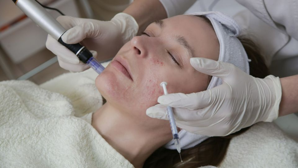 Skin Booster DNA Salmon